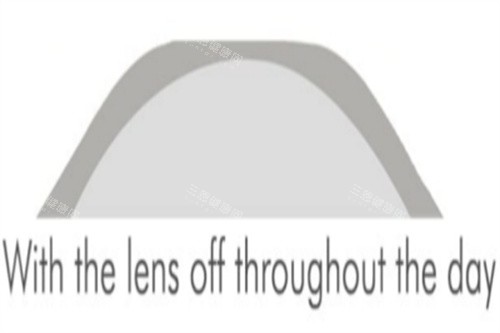 4角膜塑形镜 4角膜塑形镜