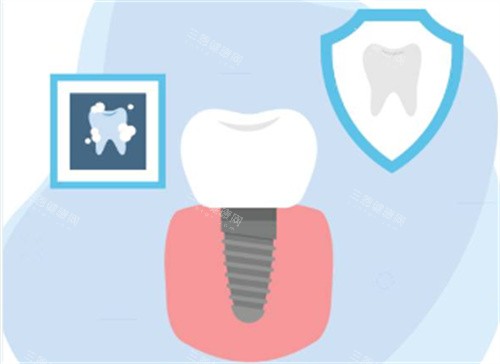 种植牙术后图 种植牙术后图