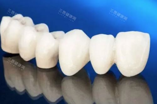 爱尔创全瓷牙模型图 爱尔创全瓷牙模型图