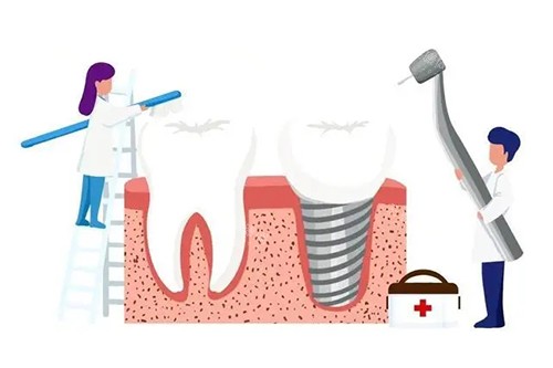 牙齿清洁维护卡通示意图 牙齿清洁维护卡通示意图