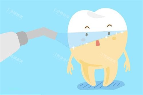牙齿冷光美白示意图 牙齿冷光美白示意图