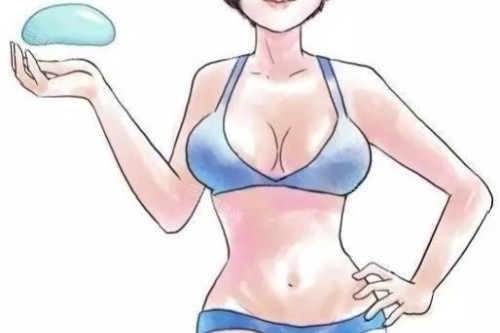 假体丰胸卡通图 假体丰胸卡通图