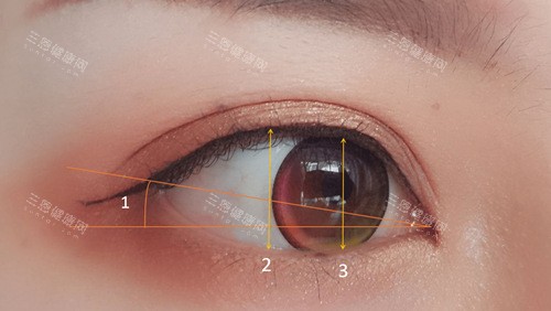 中山眼科项目价格表来啦！近视矫正9800元起/白内障3000元起/青光眼2100元起！