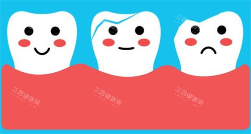 牙齿萌萌图 牙齿萌萌图