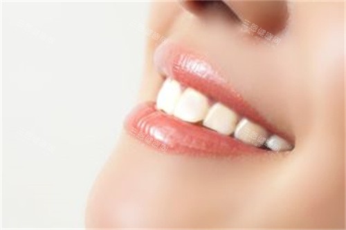 洁白整齐的牙齿宣传图