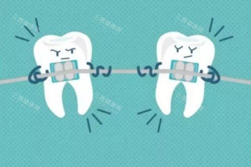 牙齿矫正卡通图