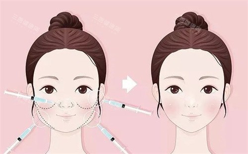 馒化脸修复前后 馒化脸修复前后