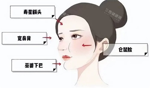 朱慧东馒头修复口碑怎么样？网友晒图：鼻基底填坏修复后法令纹变浅，沟通耐心！