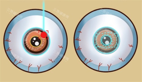 2026西安佰视佳眼科医院价格表全解析：近视、白内障、OK镜等项目费用透明公开