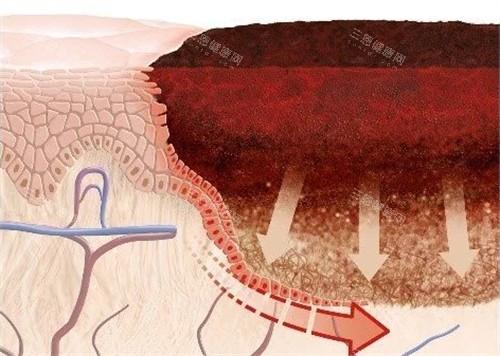健康皮肤科和疤痕 健康皮肤科和疤痕