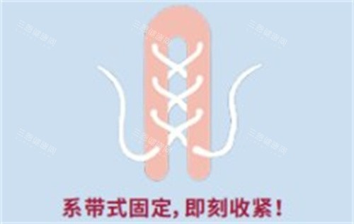 再生阴道紧缩术 再生阴道紧缩术