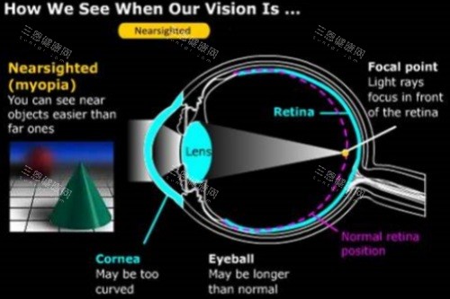 2025-2026南充友豪医院眼科价格表不掺水！4940角膜塑形镜到4.4w起ICL，覆盖近视/白内障/青光眼全项目