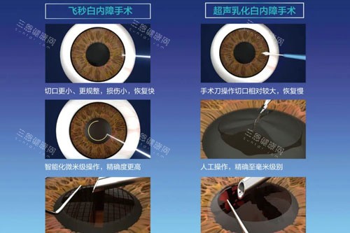 宁夏回族自治区人民医院眼科白内障价格重磅出新！超声乳化4500+单焦点晶体3200+60岁以上老人享贴补