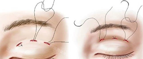 杨庆华医生怎么预约？预约方式、联系电话、擅长项目、技术优势、真实口碑等全解析！