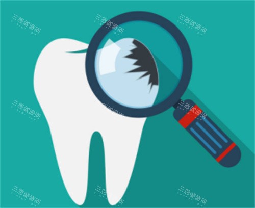 牙齿检查图 牙齿检查图