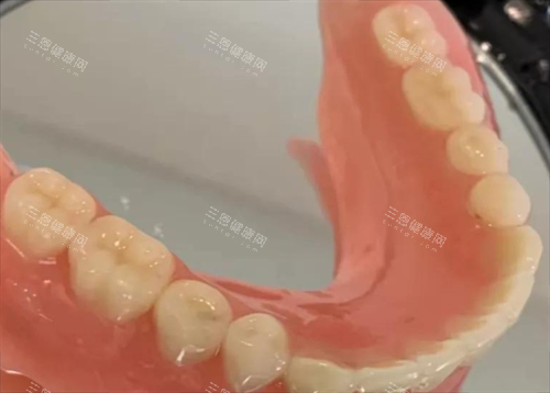 半口固定假牙模型展示 半口固定假牙模型展示