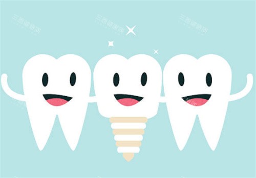 种植牙和健康牙齿图 种植牙和健康牙齿图