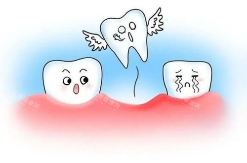 牙齿脱落示意图 牙齿脱落示意图