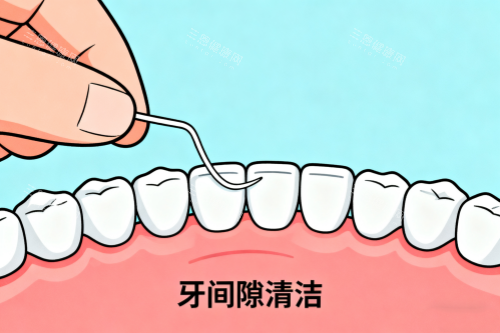 牙齿间隙清洁卡通图 牙齿间隙清洁卡通图