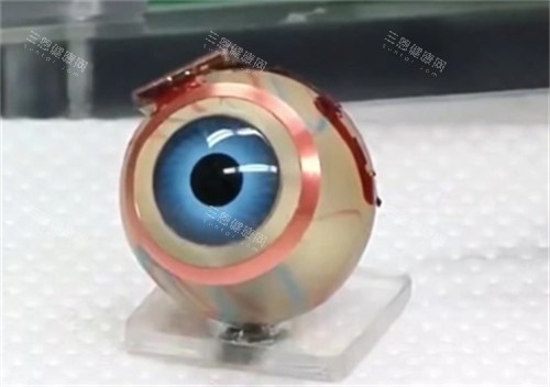 仿生眼球的样子 仿生眼球的样子