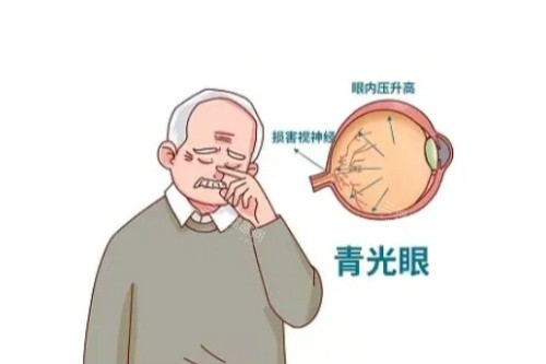 青光眼卡通一览图 青光眼卡通一览图