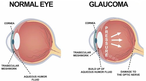 深圳市眼科医院靠谱吗？中医眼科为深圳特色专科，全专科配置满足多元需求