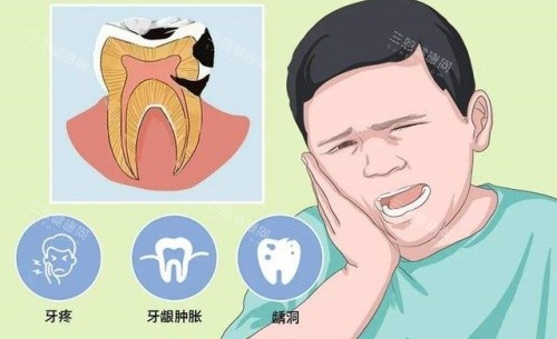 牙齿疾病示意图