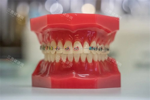 牙齿矫正宣传展示