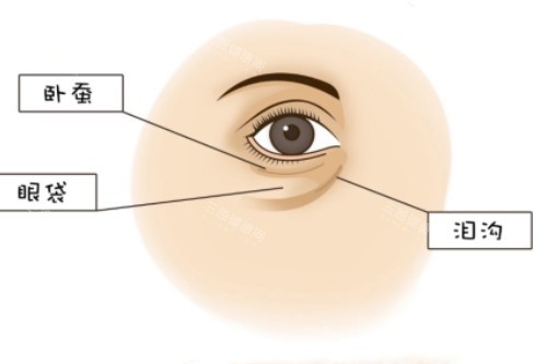 卧蚕、眼袋、泪沟展示图
