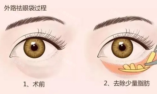 郑州王杨医生在哪个医院坐诊?农业路71号河南省职工医院详细地址大公开,交通指南全解析!