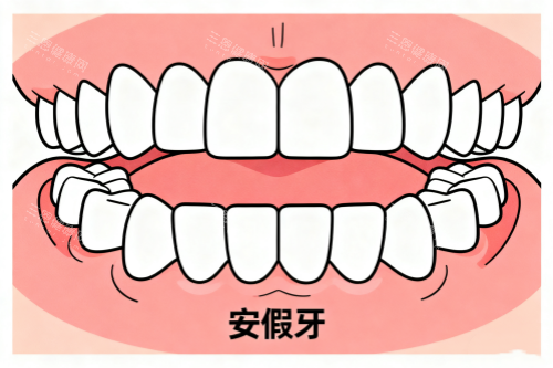 假牙卡通展示图