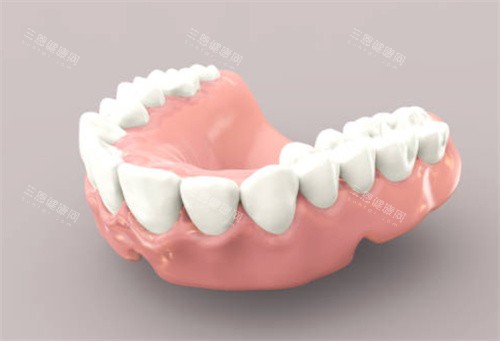 假牙模型图
