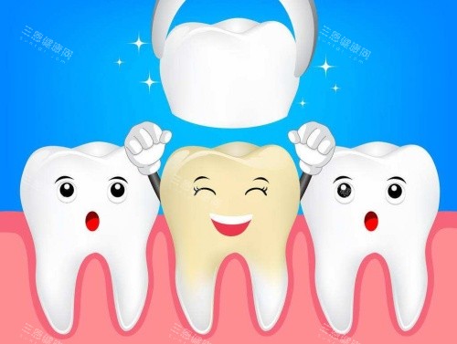 烤瓷牙义齿修复示意图