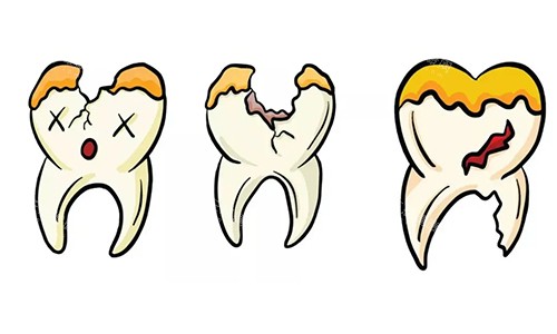 武都牙科医院怎么选?本地人实测大乐口腔|新瑞尔|葛医生三家技术价格口碑全对比