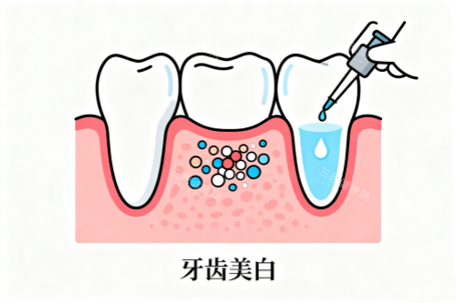 牙齿美白卡通展示图