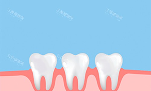 牙齿动画展示图