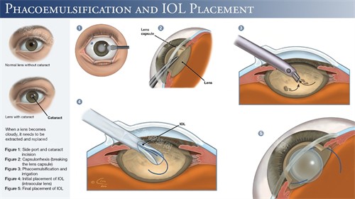 青岛眼科医院网上预约挂号全指南！挂号方式+小贴士，收藏备用！