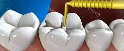 烟台栖霞补牙哪家强？五家正规口腔机构特色对比与推荐