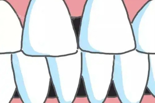 莱州仁爱口腔医院真实评价：技术靠谱吗？看牙贵不贵？听听患者怎么说