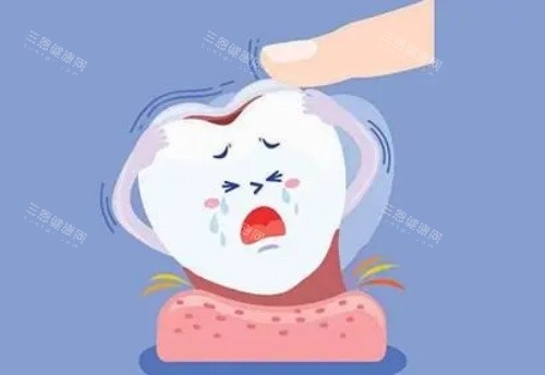 单颗牙齿漫画示意图