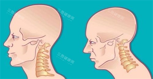 李方伟富贵包收费明细一览，轻度富贵包9800元起、中度16580元起、重度26580元起~