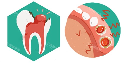 深圳南山区种牙医院哪家强？同步/曙光/拜博口腔真实测评，种牙就选这几家靠谱！