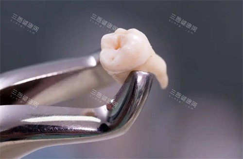 拔掉的牙齿照片