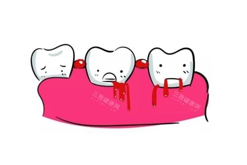 牙齿出血卡通图片展示