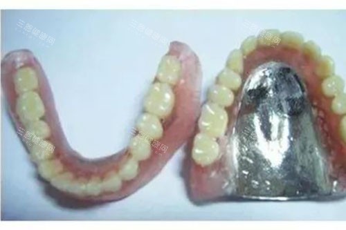 纯钛活动义齿 纯钛活动义齿
