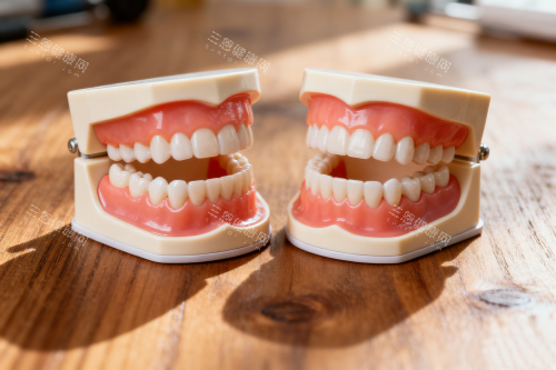 全口假牙模型一览