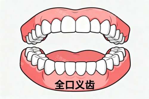 70岁老人全口假牙价目表参考：半口3000元起，全口2.5万元起，按需选择更省心