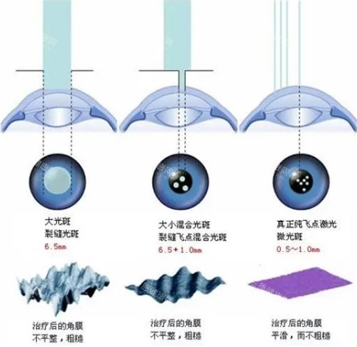 北京协和医院眼科价格表汇总：涵盖近视、白内障、OK镜等，3000元起即可就诊