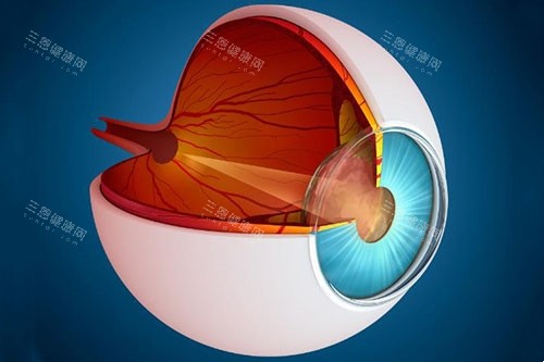 青光眼侧面解刨图片 青光眼侧面解刨图片