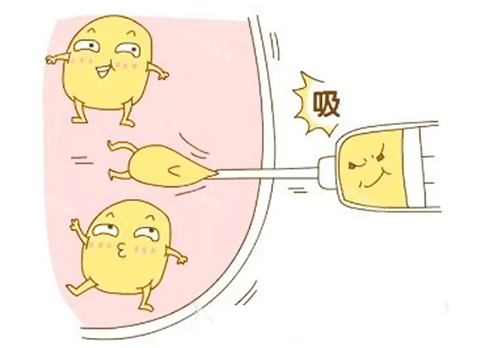 吸脂生动卡通图 吸脂生动卡通图